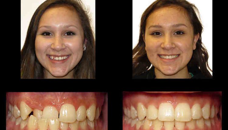 Superior wi cosmetic dentistry
