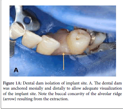 What UC schools have a dental program?