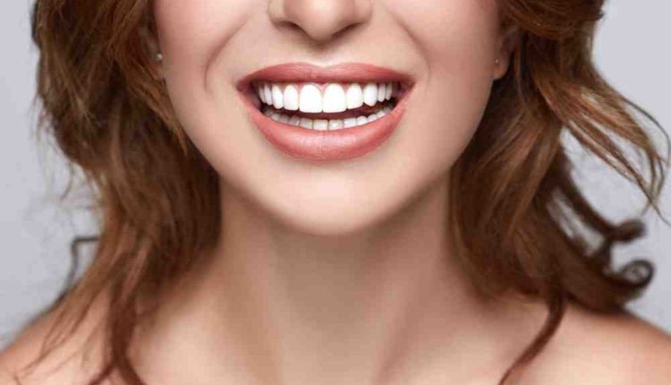 What are cons of veneers?