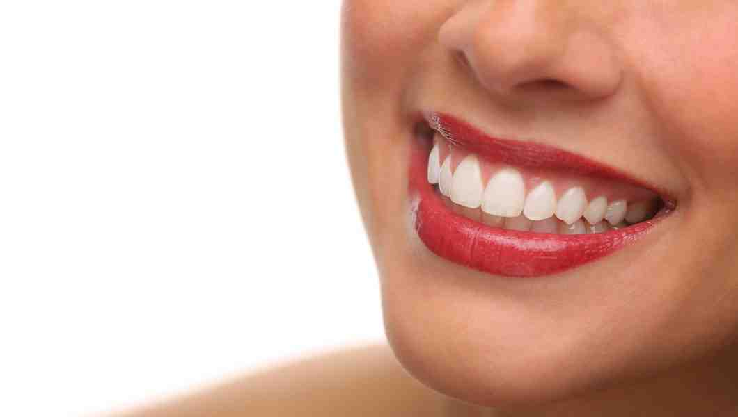 What are disadvantages of veneers?