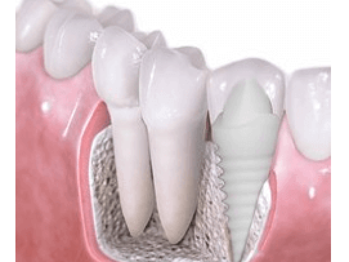 What does 7 mean at the dentist?