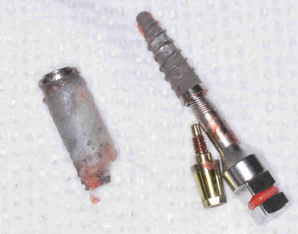 What holds dental implants in place?