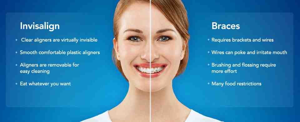 What is a flipper tooth?