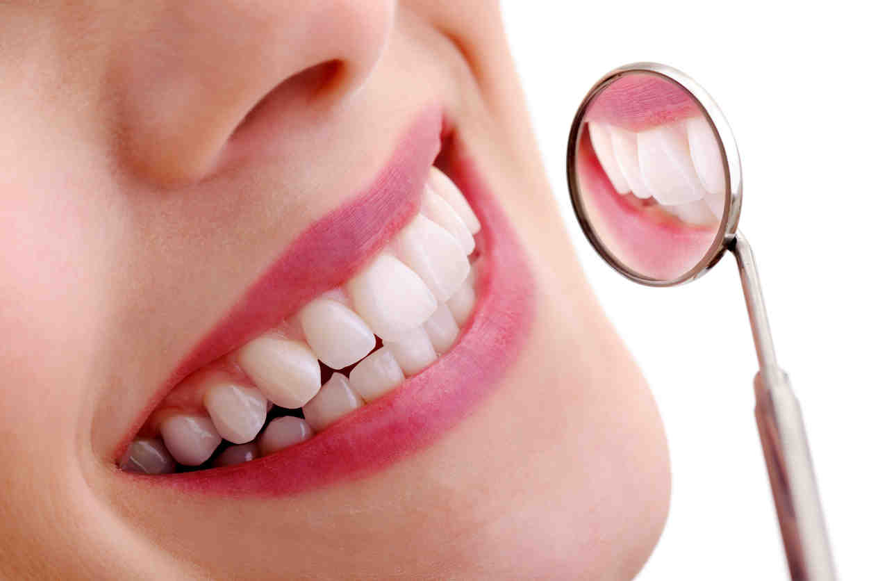 What is a mini smile makeover?