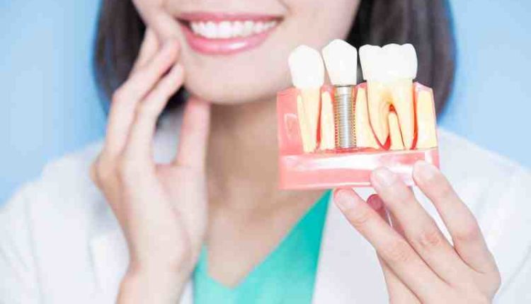 What is it like to get dental implants