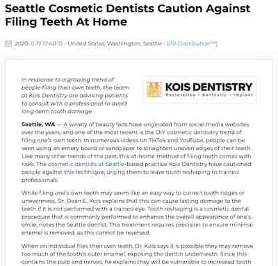 What is the best color for veneers?