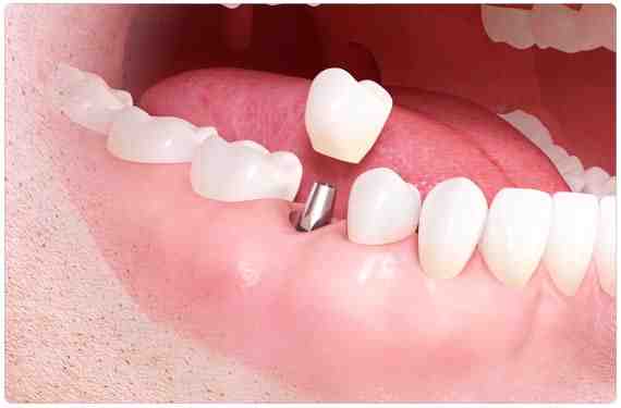 What is the best country to get dental work done?
