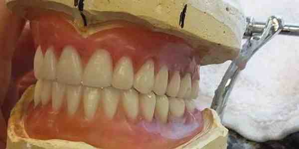 What is the cheapest state to get dental work done?
