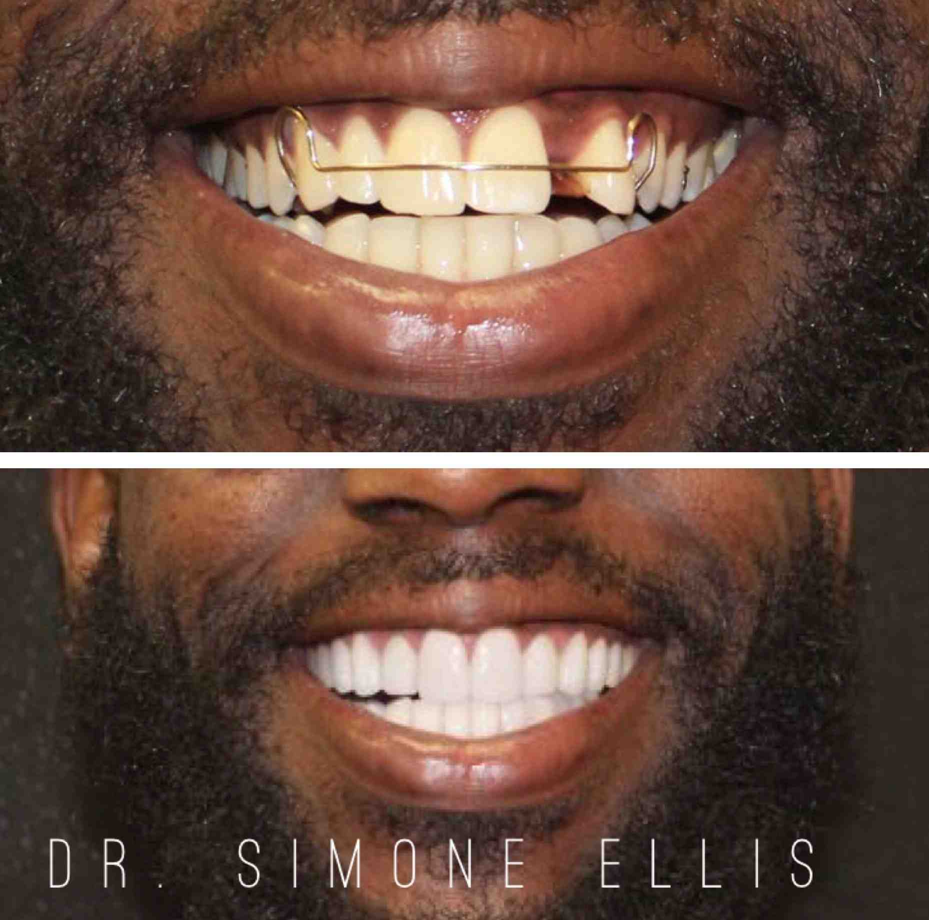 Smile design studios family and cosmetic dentistry missouri city, tx