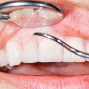 Which country has the best dental care in the world?