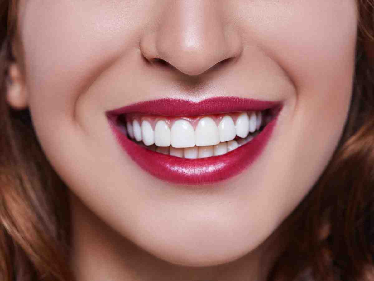 What are veneers teeth made of? Dental News Network