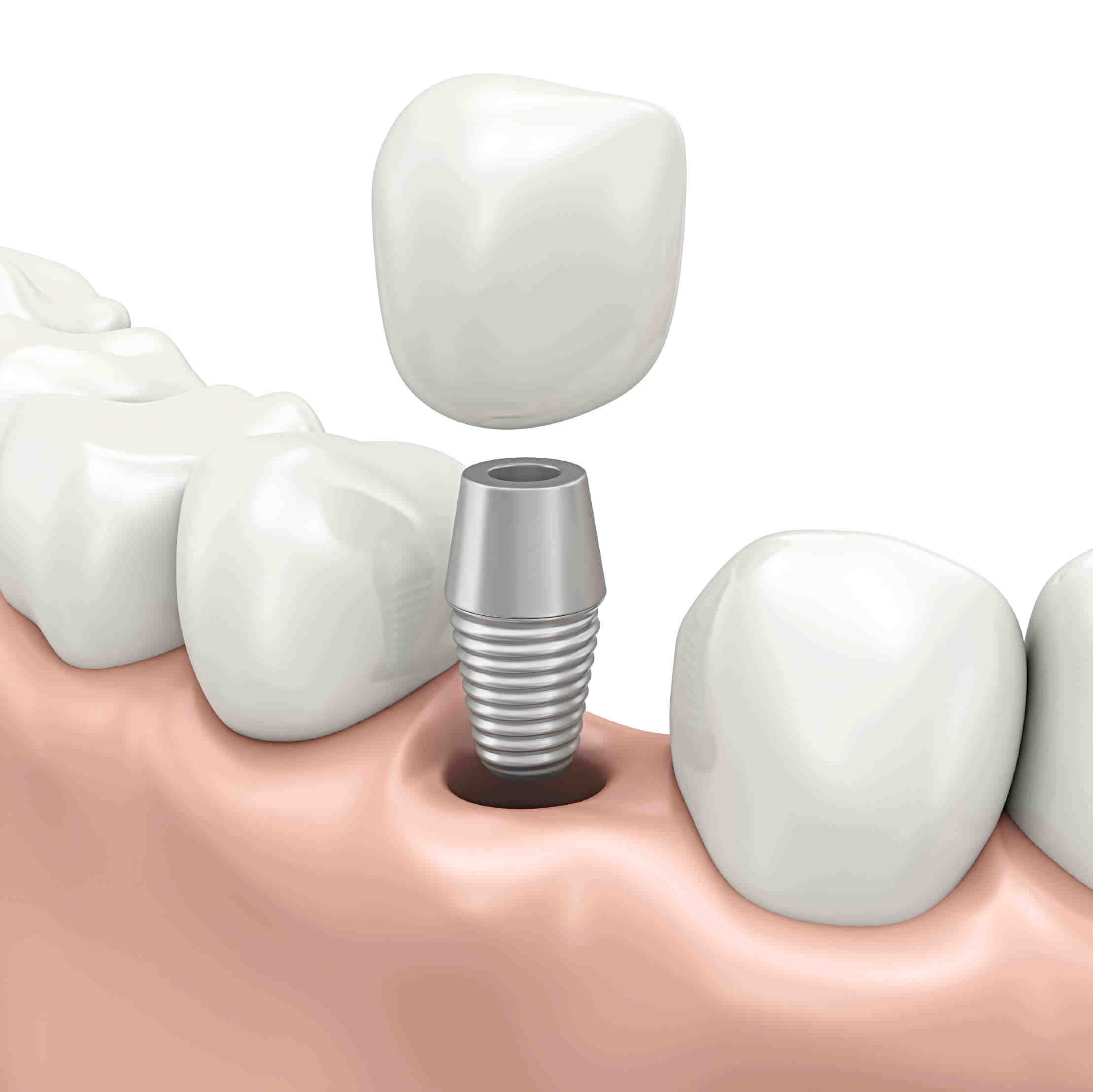 Who makes more money an orthodontist or a dentist?