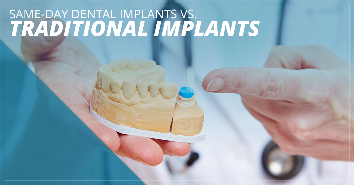 Why do dental implants fail?