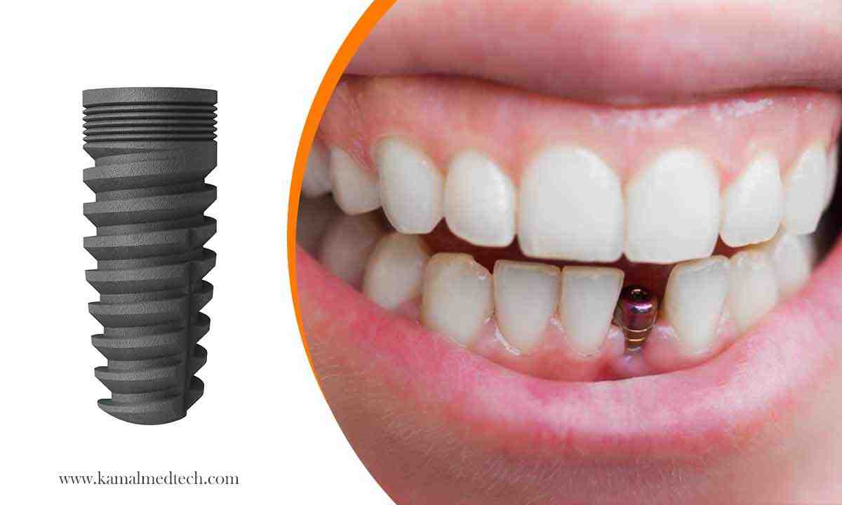 Why do my dental implants hurt at night?