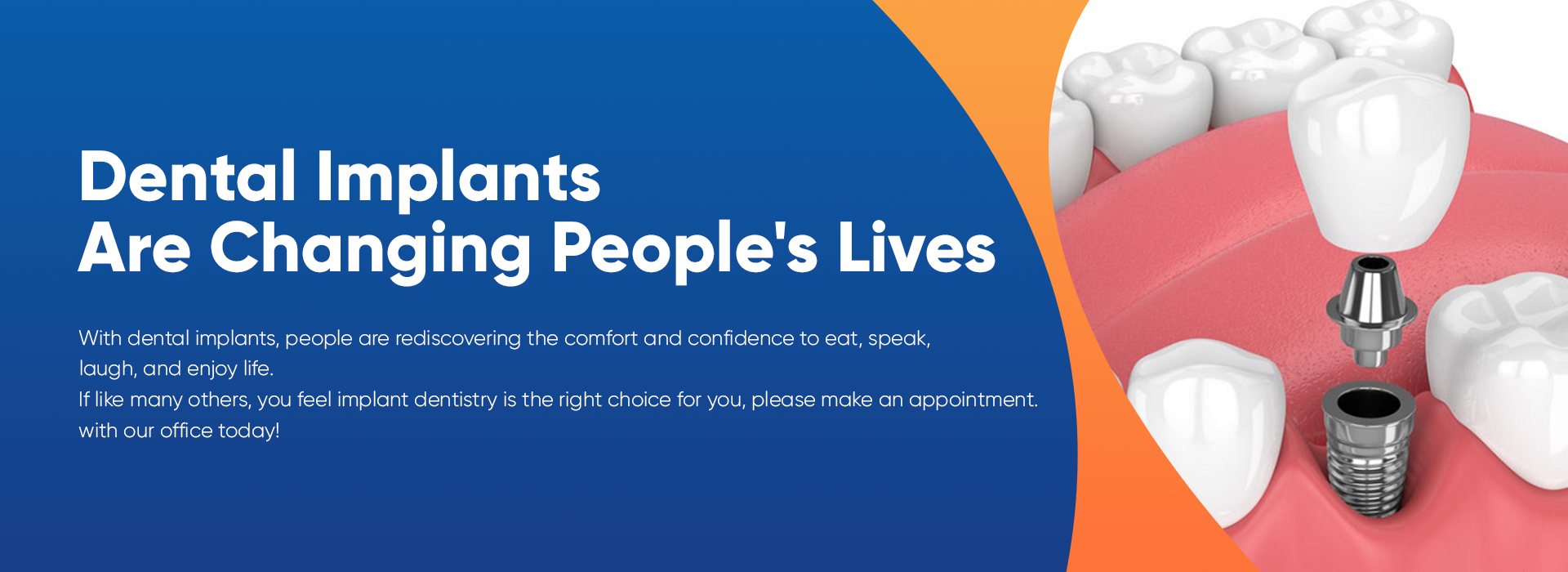 Why you should not get dental implants?