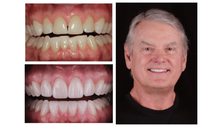 Are braces considered cosmetic dentistry?