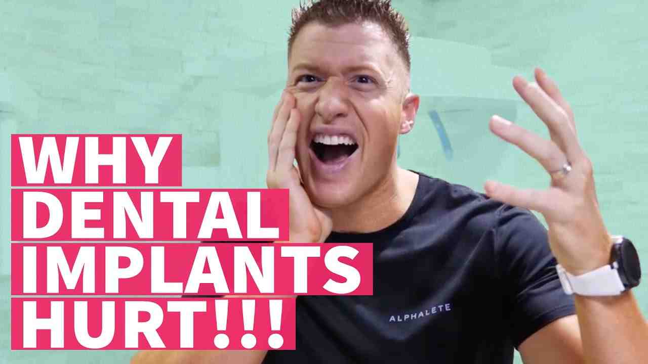 Are you put to sleep for dental implants?