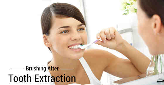 Can I drink coffee after dental implant?