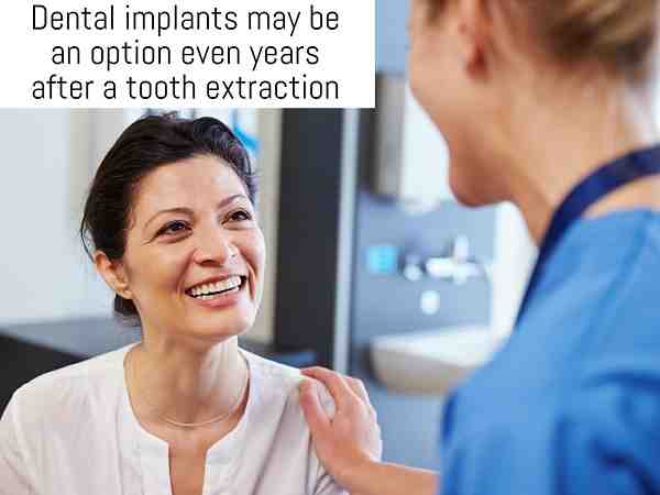 Can I get an implant 2 years after extraction?
