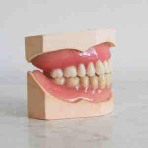Can I have all my teeth pulled and get dentures?