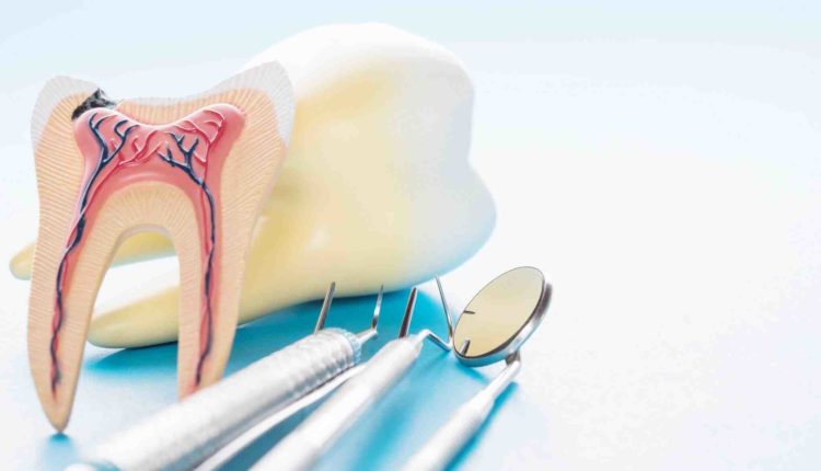 Can a general dentist do a root canal?