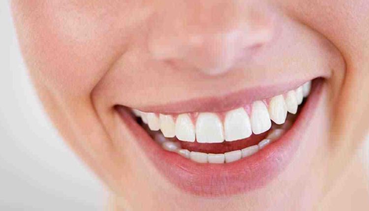 Can cosmetic braces damage your teeth?