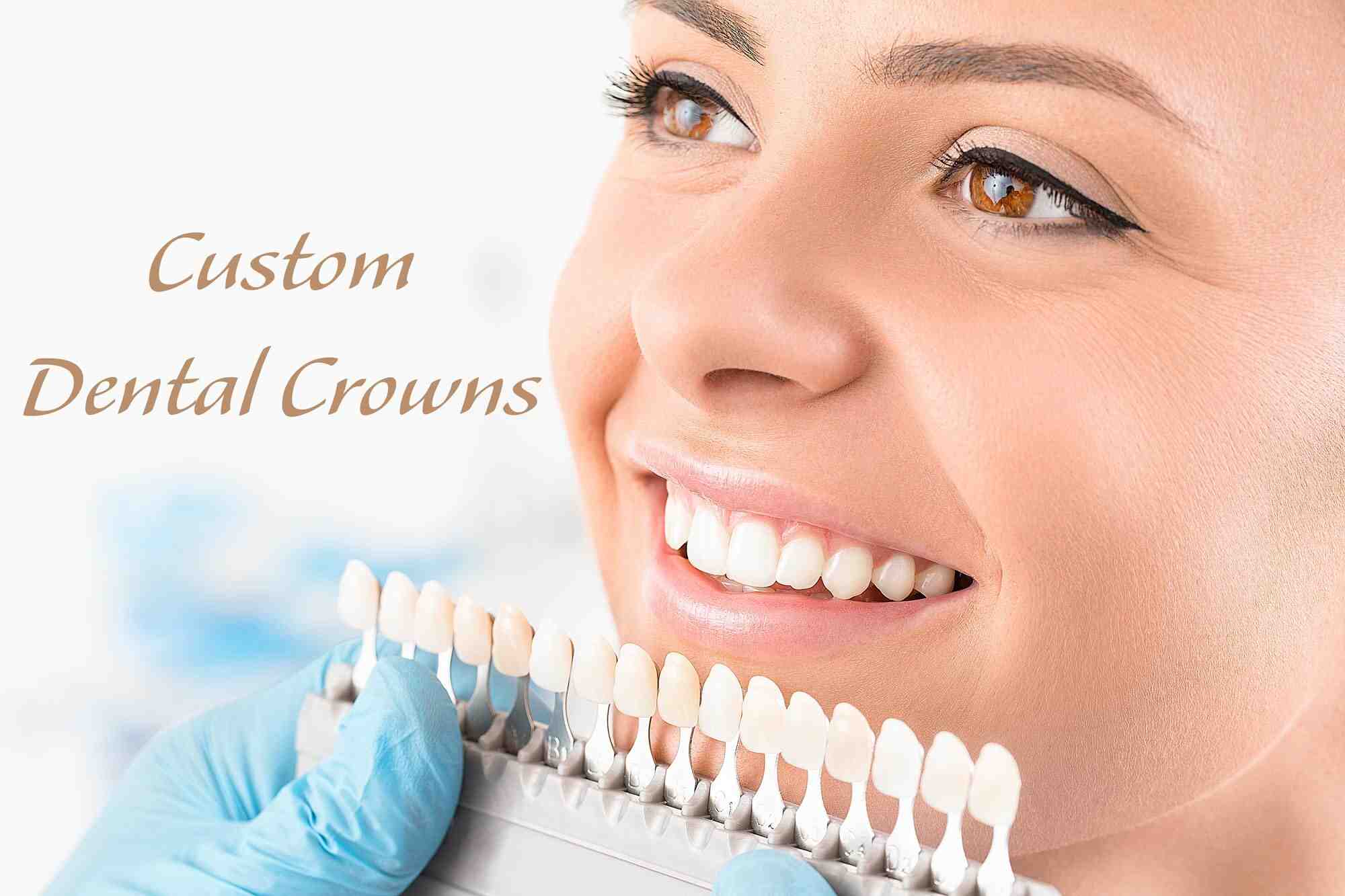 Can crowns be whitened?