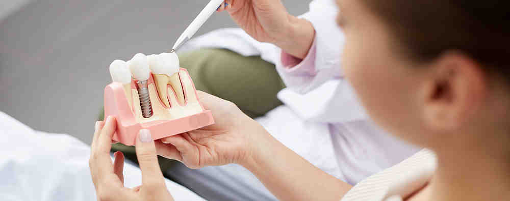 Can dental implants be done in 1 day?