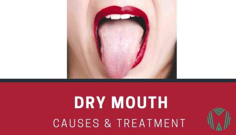 Can dental implants cause dry mouth