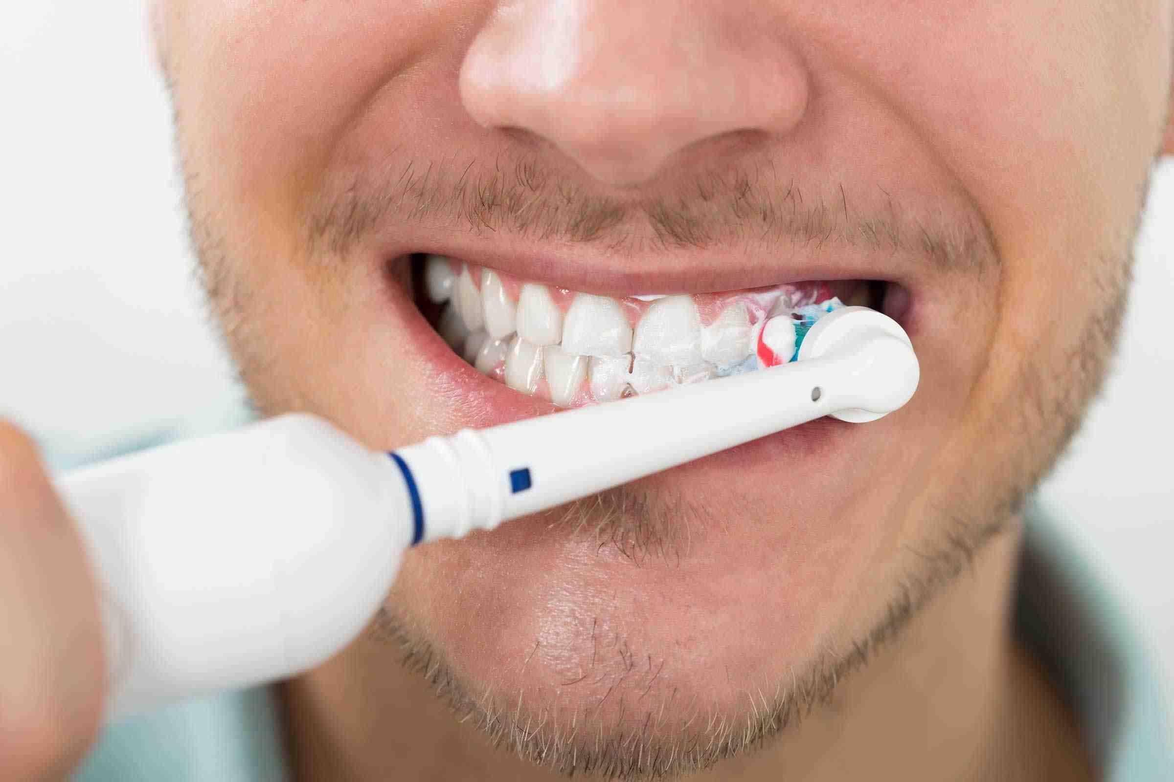 Can yellow teeth become white again?