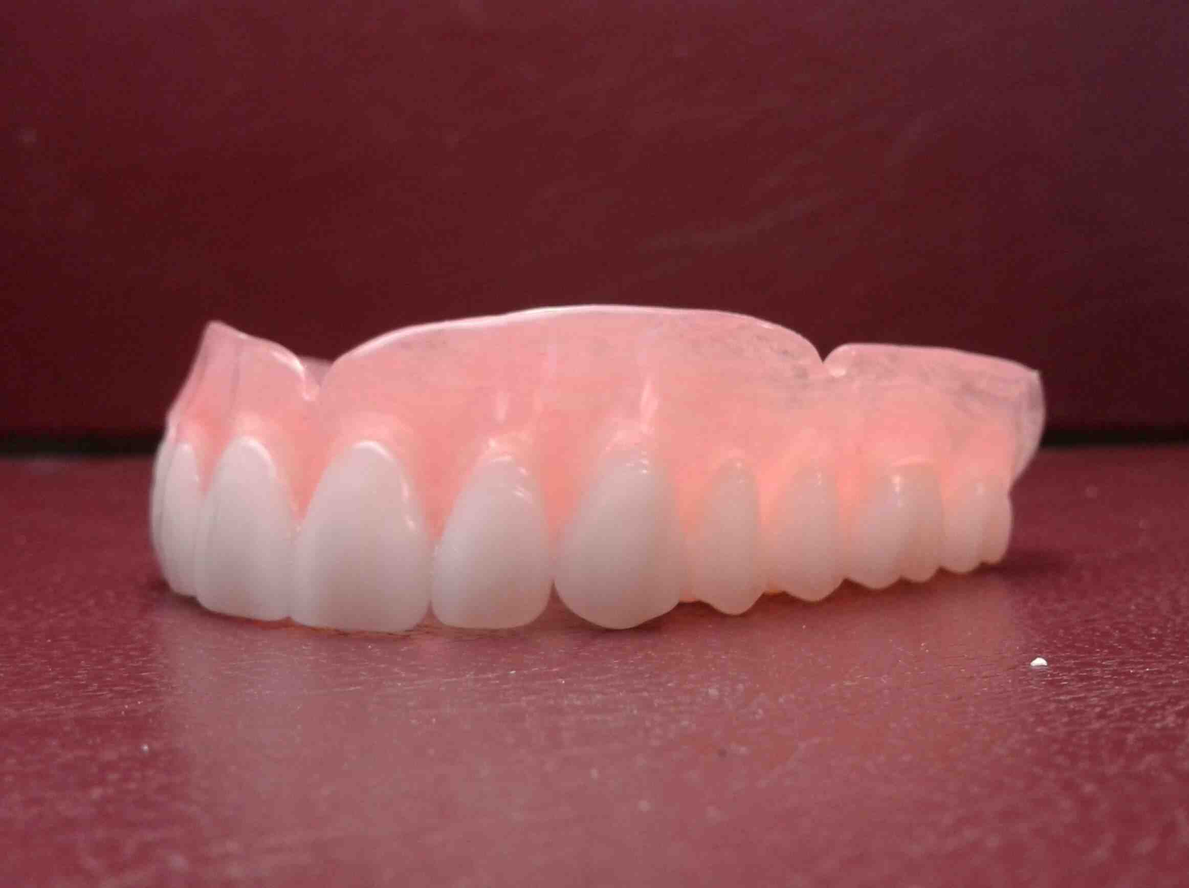 Can you just have upper dentures?