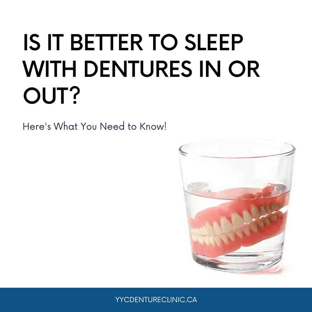 Can you leave full dentures in overnight?
