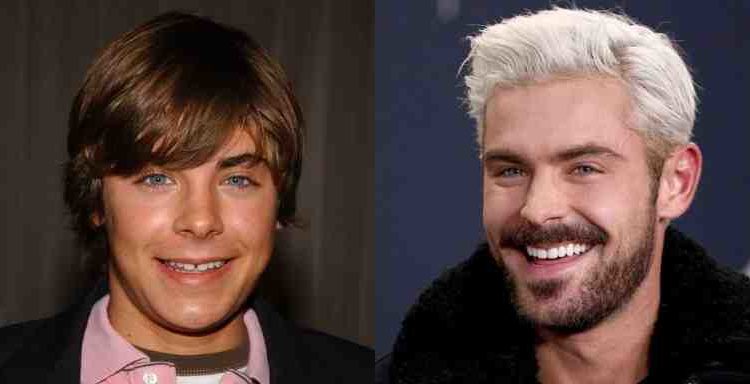 Do celebrities wear dentures?