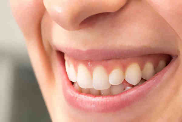 Do dentists deliberately damage teeth?