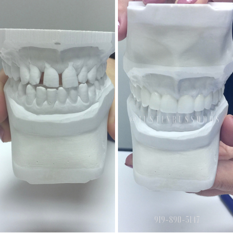 Do dentists earn more than doctors?