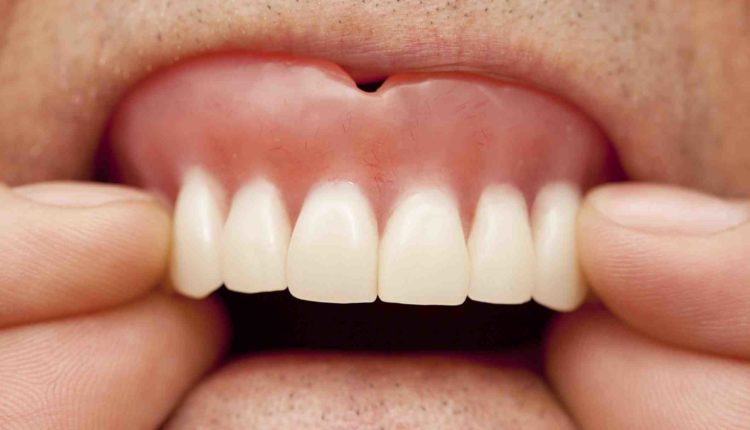 Do dentures feel like real teeth?