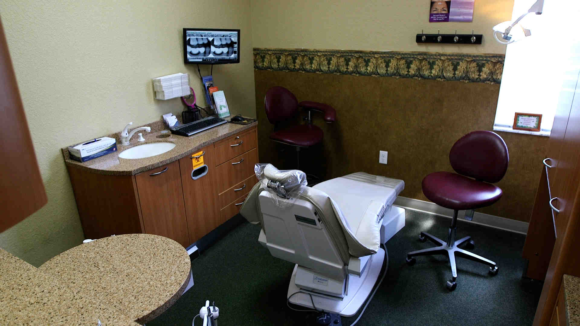 Do veneers get cavities?