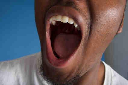 Do veneers make your mouth dry?
