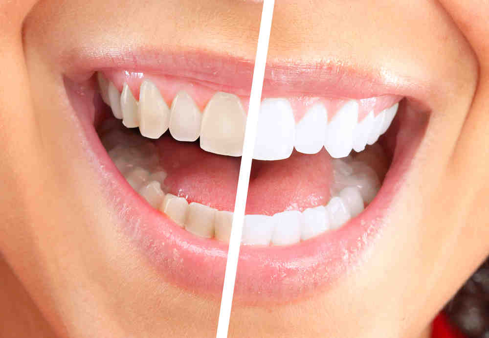Do you close your eyes at the dentist?
