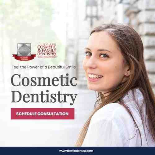 Do you need root canal for veneers?