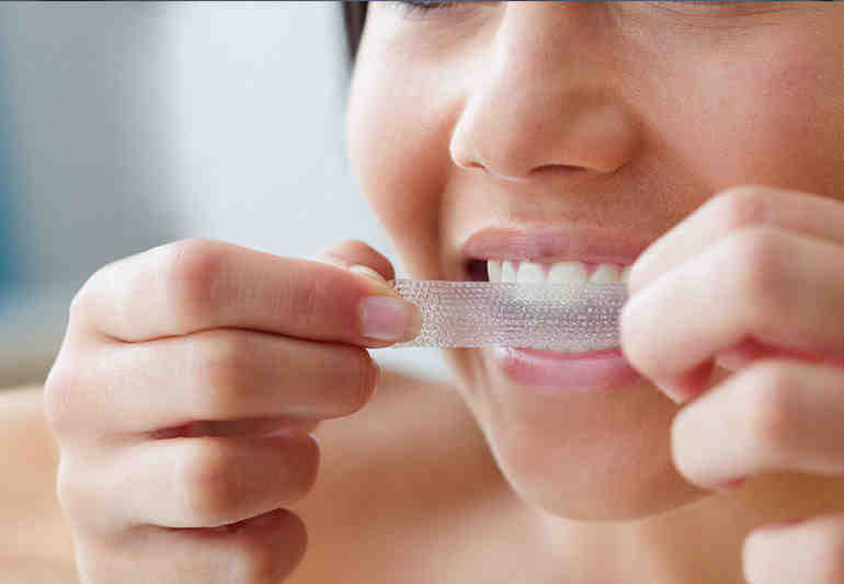 How are peoples teeth so white?