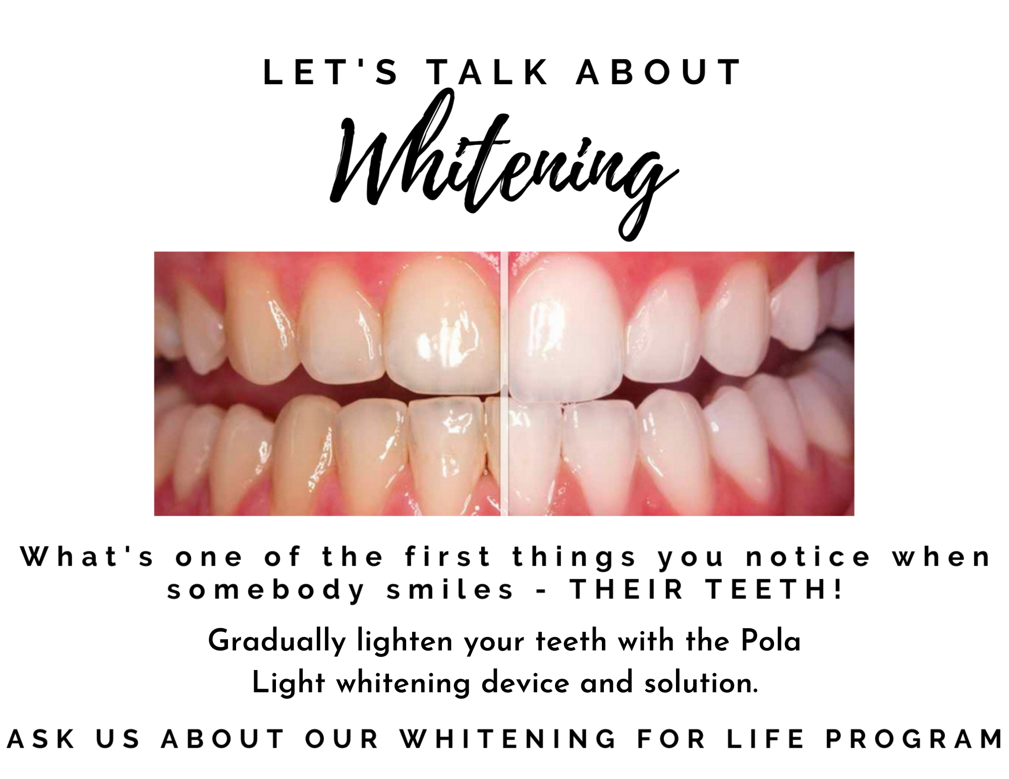 How can I remove yellow from my teeth naturally?