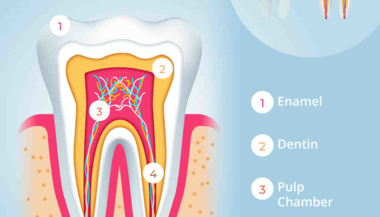 How do you know when u need a root canal?