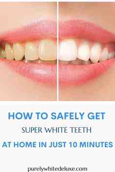 How fast does baking soda whiten teeth?