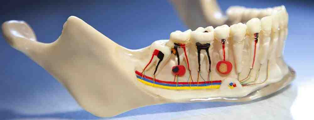 How long can an infected root canal go untreated?