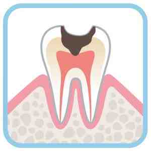 How long do dental crowns last?