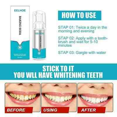 How long does it take for baking soda to whiten teeth?