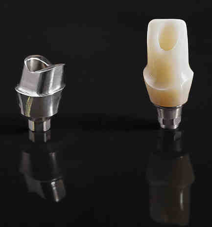 How long does it take for bone to heal for implant?