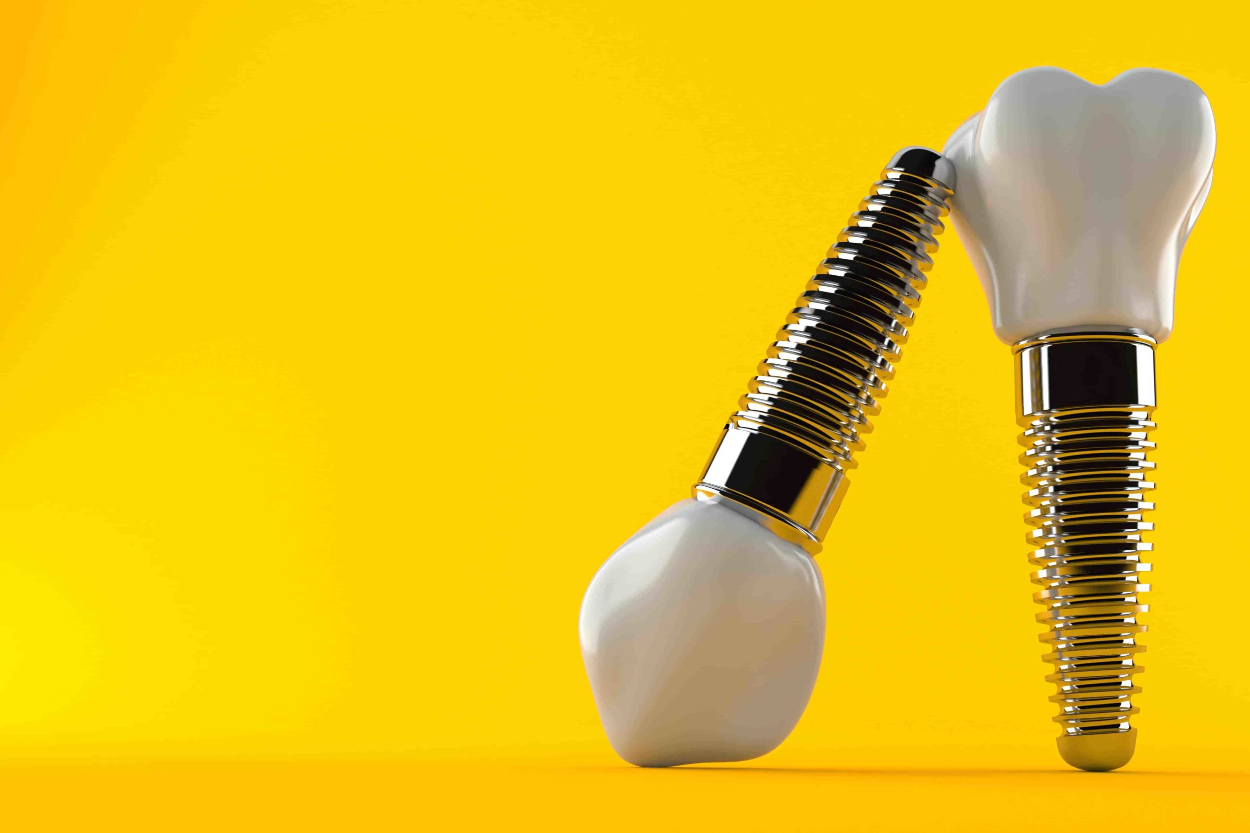 How long does it take for gums to heal after dental implants?