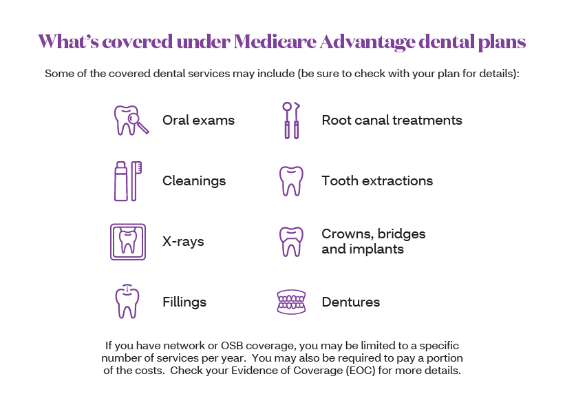 How long does it take to fix a missing tooth?